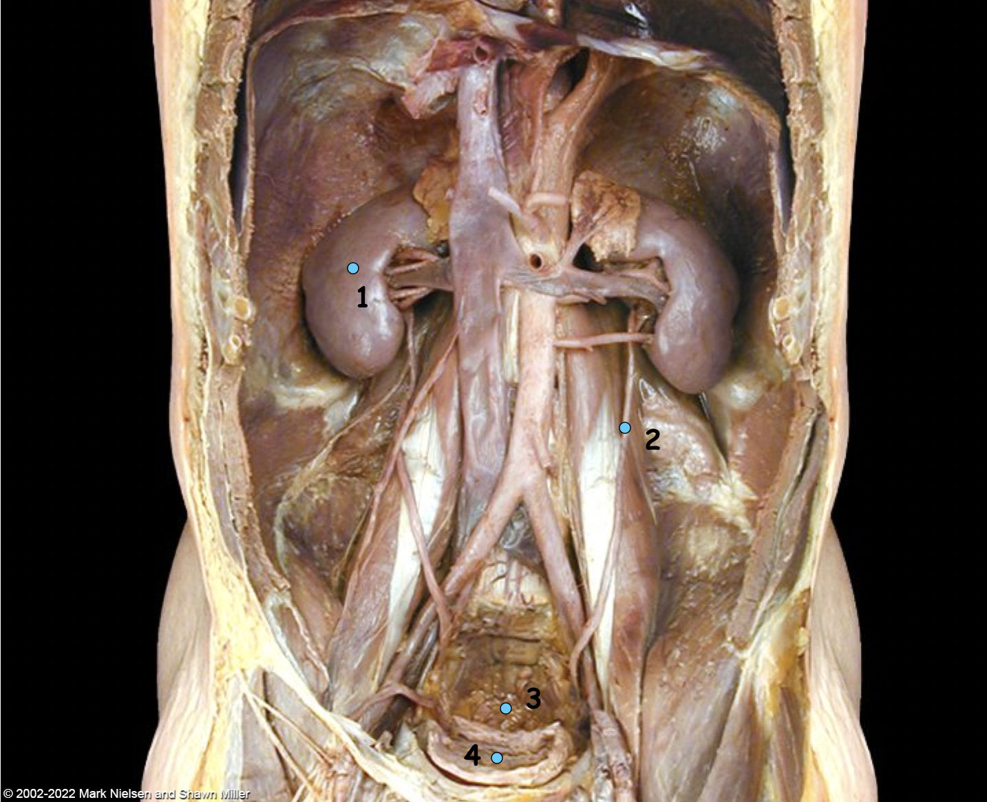 <p>What is number 1</p>