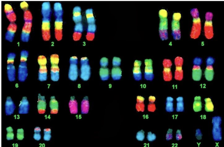 <p><span>organized profile of an individual's chromosomes, displaying their number, size, and shape, often presented as a laboratory-produced image</span></p>