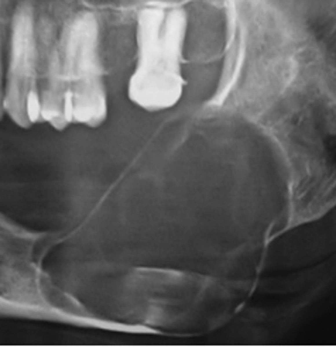 <p>what is the normal periphery/margins of benign tumors?</p>