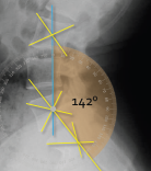 <p>Q what is the name of this measurement? and what is the average + range?</p>