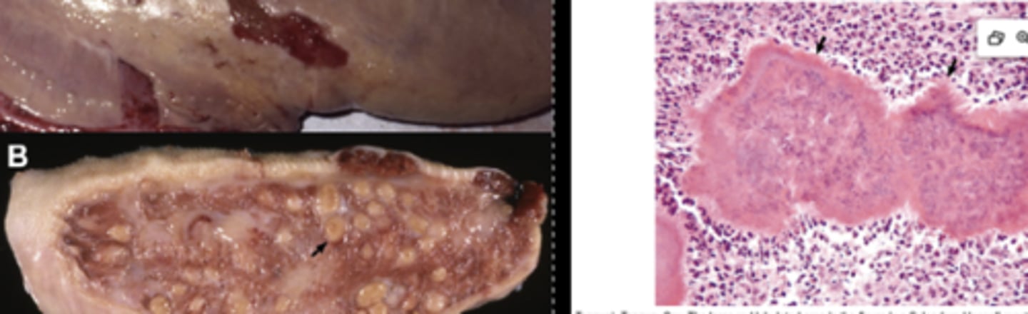 <p>What type of virulence factor is used by actinobacillus ligneresi to cause this pyogranulomatous inflammatory response? </p>