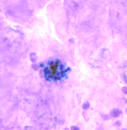 <p>Dr. Vicente Y. Belizario Jr.</p>