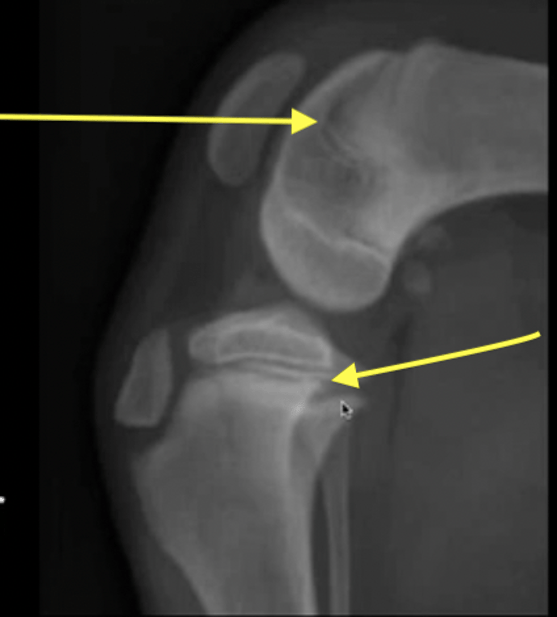 <p>What are the arrows pointing to?</p>