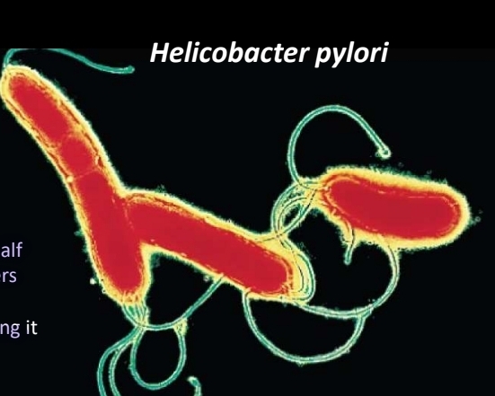 <p>Proteobacteria</p>