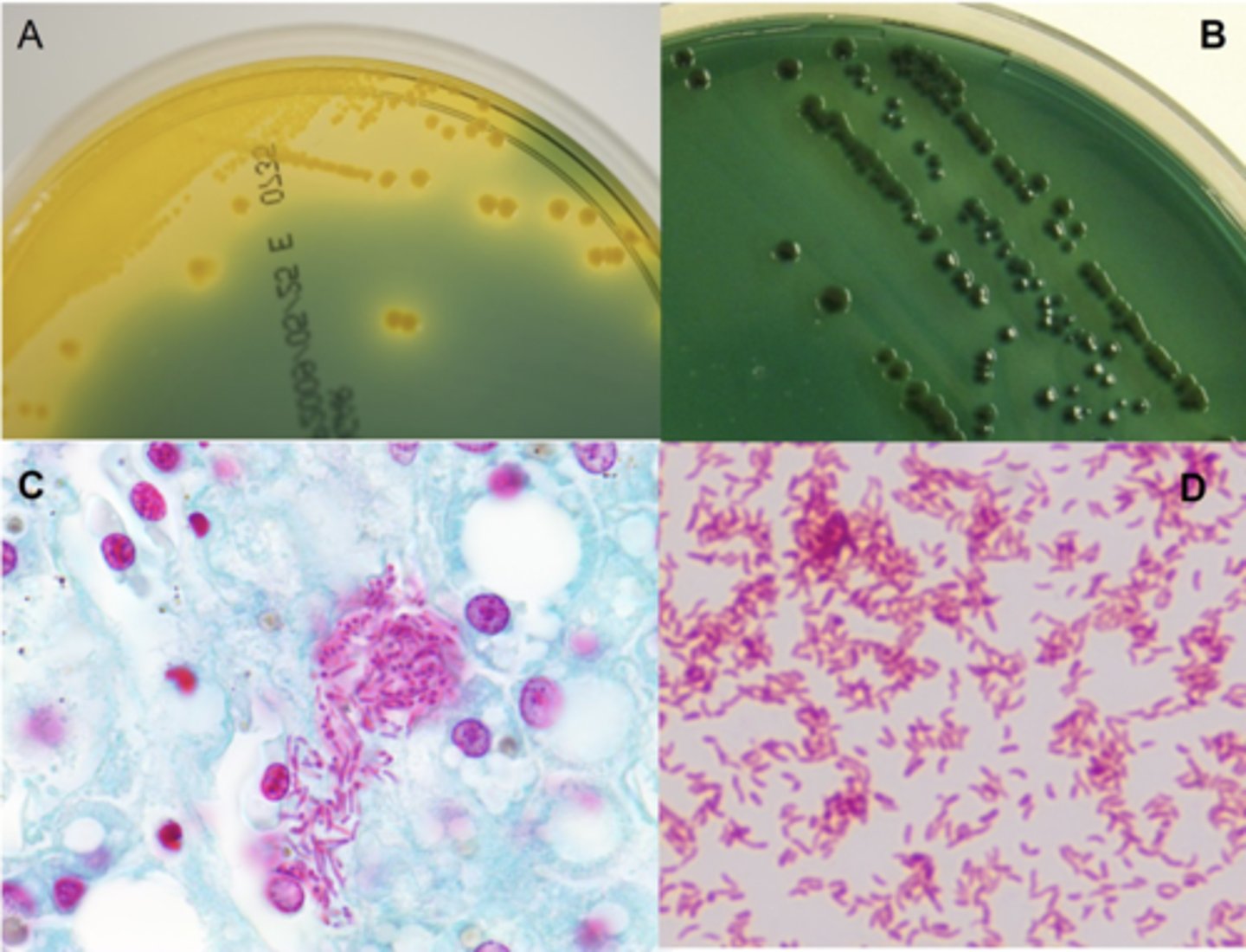 <p>1. Fresh lesions can be scraped and wet mounted</p><p>2. Fix in 10% buffered formalin</p><p>3. Fresh Samples</p><p>4. Species Specific qPCR for important viral pathogens</p>