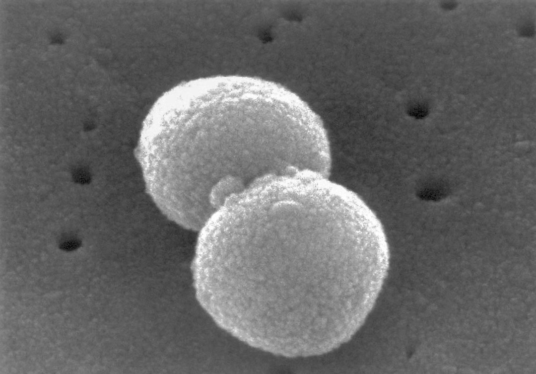 <ul><li><p>single-celled/unicellular</p></li><li><p>prok no nucleus</p></li><li><p>vary in size over wide range (smallest are bigger than alrgest known viruses and largest smaller than singlecelled euk</p></li><li><p>divide by binary fission</p></li><li><p>e.g. streptococcus pneumoniae </p></li></ul><p></p>