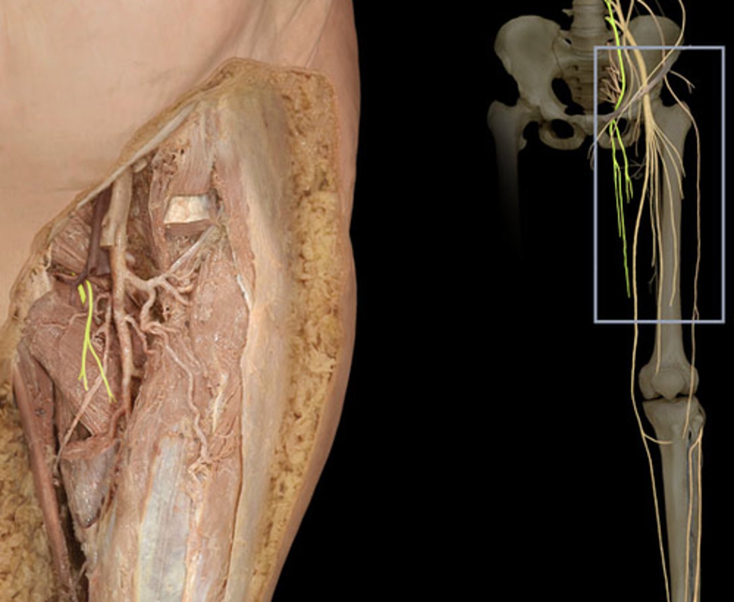 <p>- Runs down the anterior medial aspect of the thigh</p><p>- Terminates in thigh</p><p>- M: medial thigh muscles</p><p>- S: skin over the proximal part of the medial thigh</p>