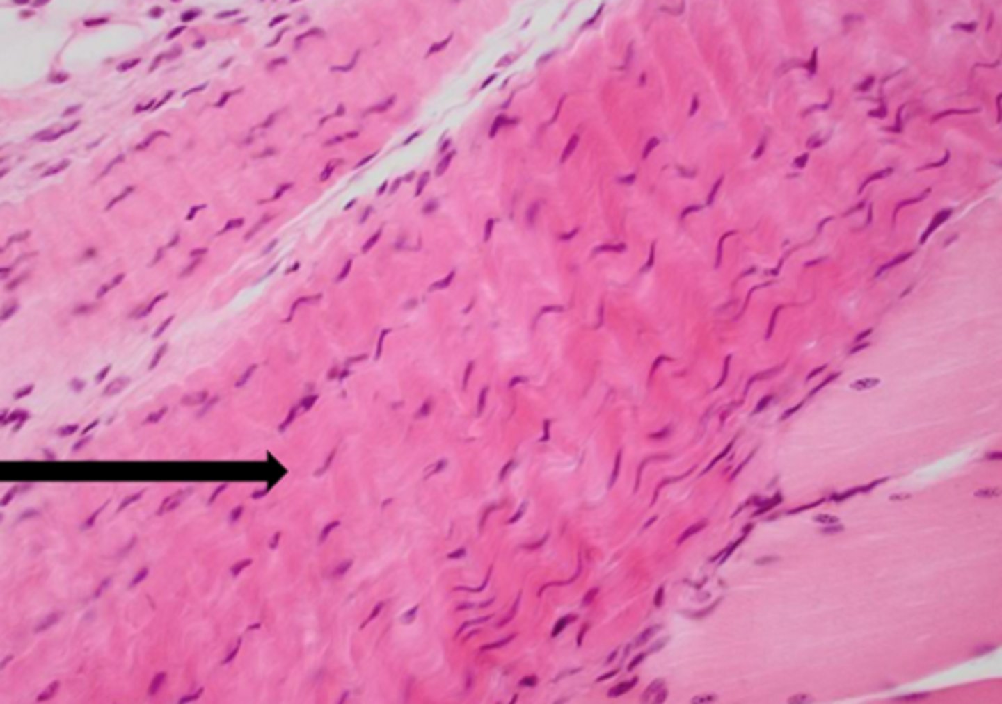 <p>name the tissue</p>