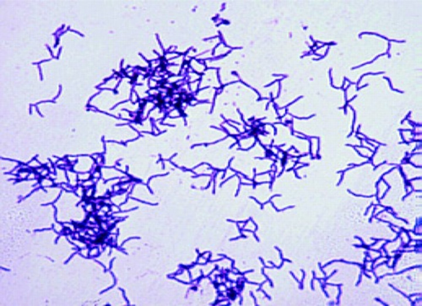 <p>- +ve filaementous</p><p>- anaerobe </p><p>- causes actinomycosis, leading to lumpy jaw or chronic oral abscesses w/ S granules</p><p>- slow-growing colonies resembling "molar tooth" on agar</p>