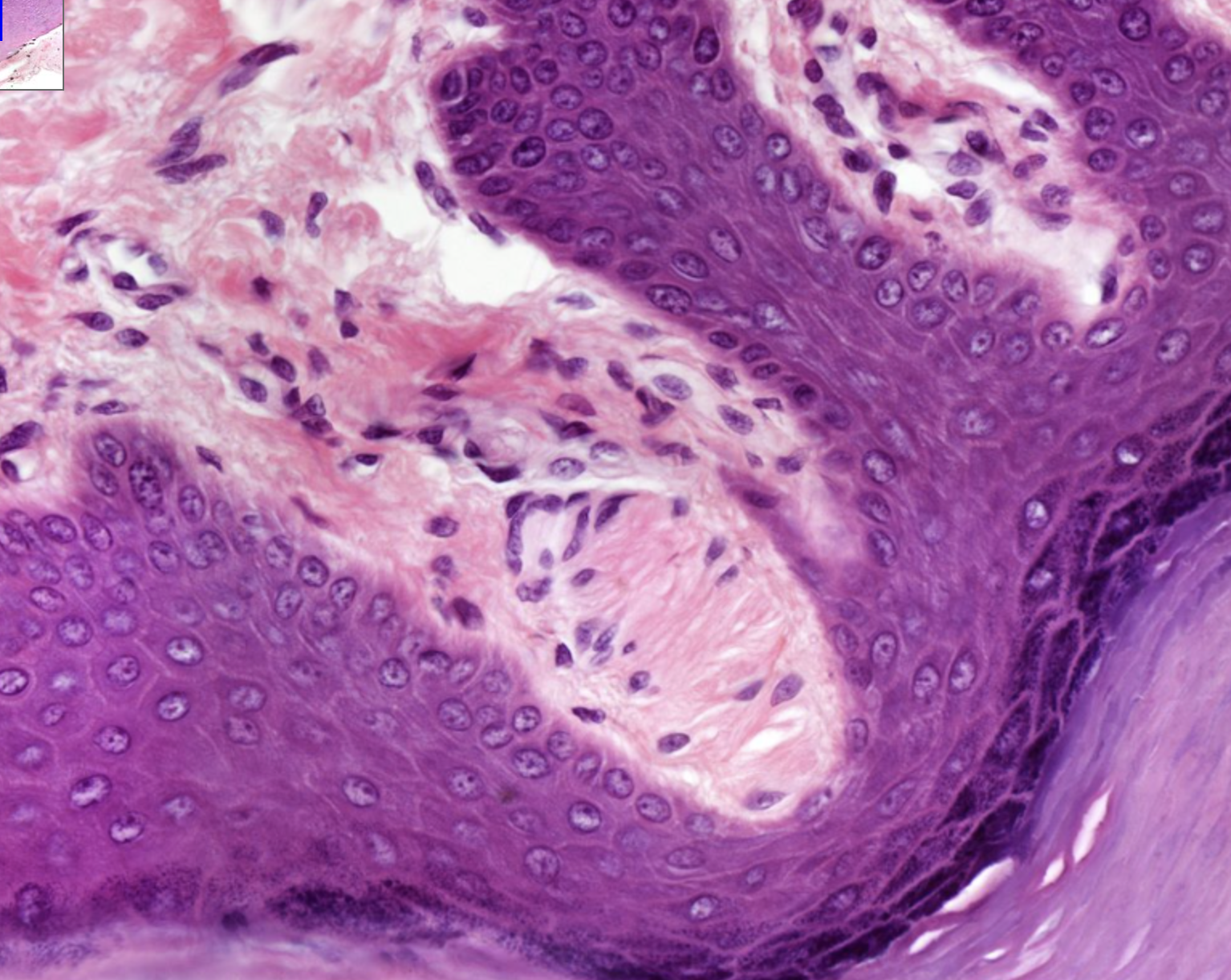 <p>within dermal papillae </p>