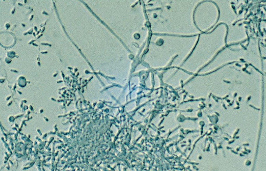 <p>Primarily globose but may appear tear shaped and measure 2.5 to 4 um. Microconidia In grape like clusters. Macroconidia are thin walled, smooth, and cigar shaped, with 4 to 5 cells</p>