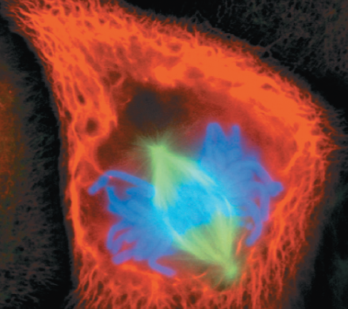 <p>What stage of mitosis is shown here?</p>