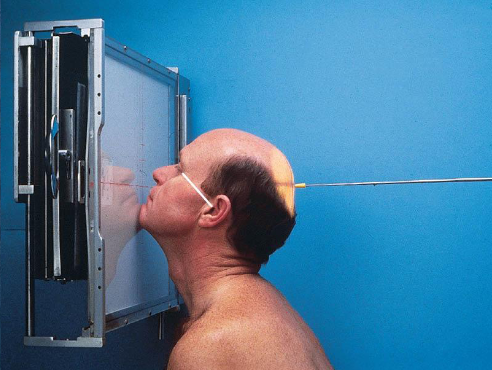 <ul><li><p>patient position:</p><ul><li><p>prone or upright</p></li><li><p>center MSP to midline</p></li></ul></li><li><p>part position:</p><ul><li><p>rest head on tip of extended chin</p><ul><li><p>nose slightly off IR</p></li></ul></li><li><p>OML adjust to form 37 degree angle with IR plane</p></li><li><p>MML perpendicular to IR</p></li><li><p>MSP perpendicular to IR</p></li><li><p>IR centered to level of acanthion</p></li></ul></li><li><p>respiration suspended</p></li><li><p>CR:</p><ul><li><p>perpendicular, exits acanthion</p></li></ul></li><li><p>collimation:</p><ul><li><p>1 inch beyond the shadows of the lateral sides of the face, superiory to include the supraorbital margins, and inferiorly to the level of the chin</p></li><li><p>no larger than 8 × 10 inches</p></li></ul></li></ul><p></p>