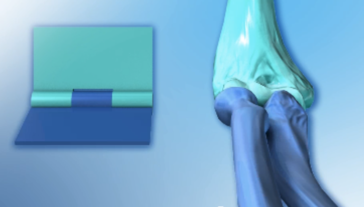 <p><span>move on one axis, allowing for flexion and extension, and include the elbow(articulation between the humerus and ulna) joint, knee and ankle joints and finger joints(interphalangeal)</span></p>