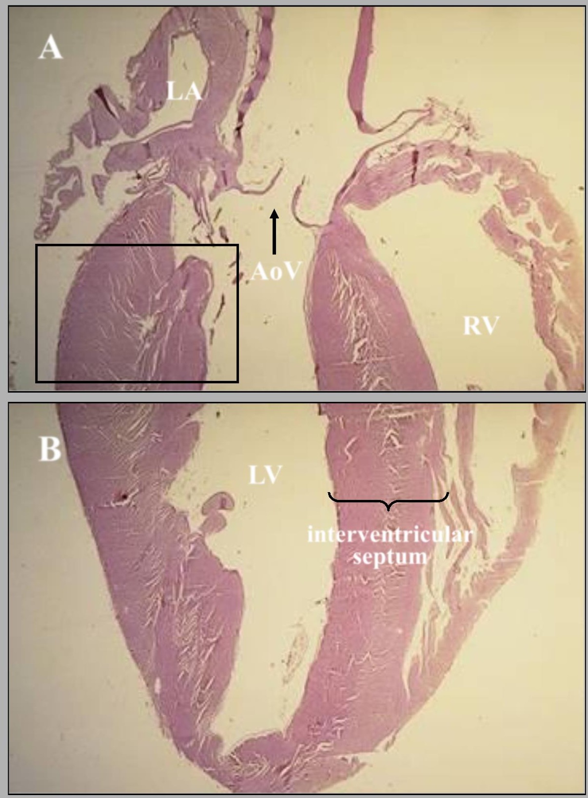 <p>name of this slide? state the parts</p>
