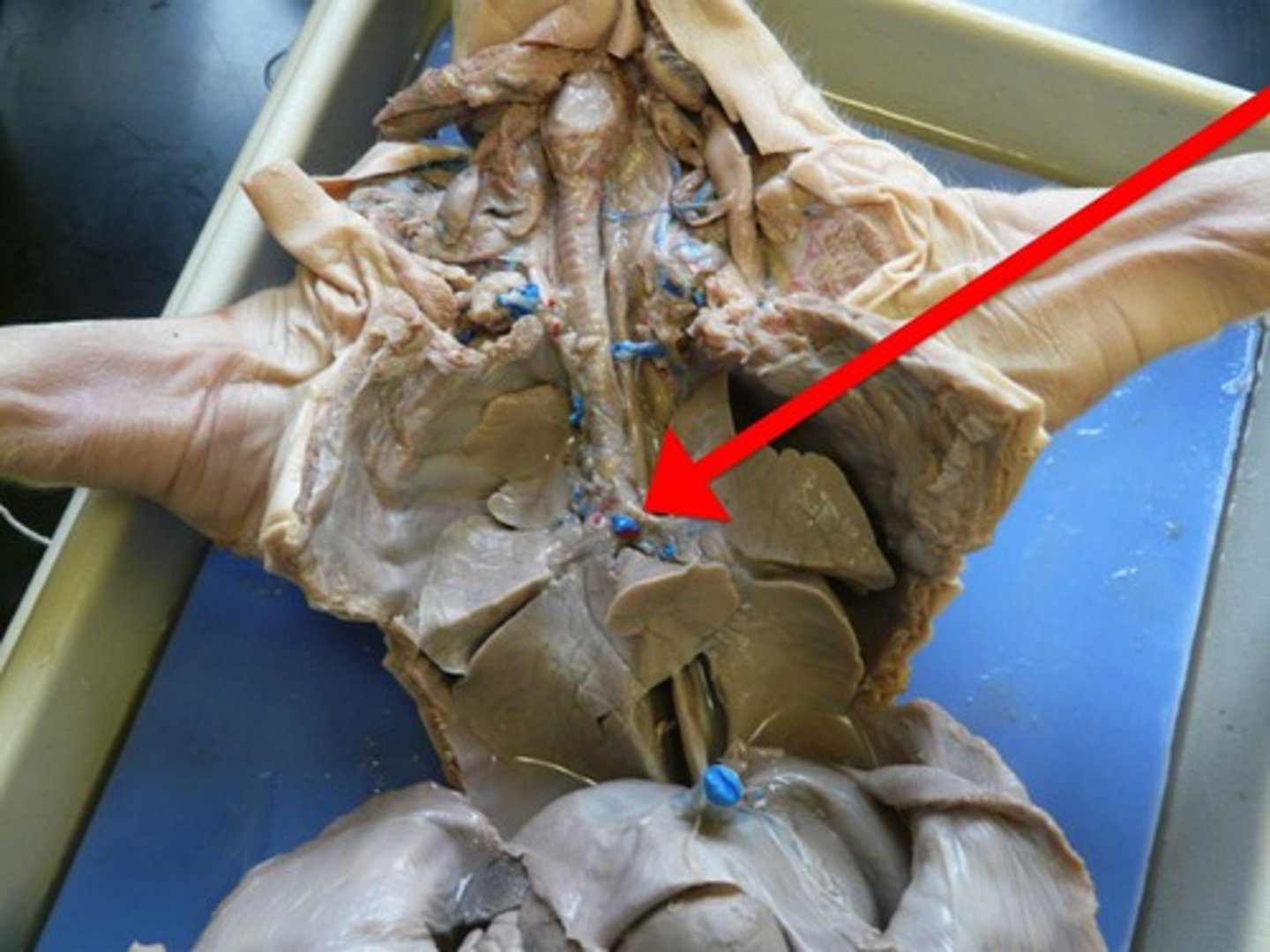 <p>The first branches of the trachea. There are two primary bronchi, one for each lung.</p>