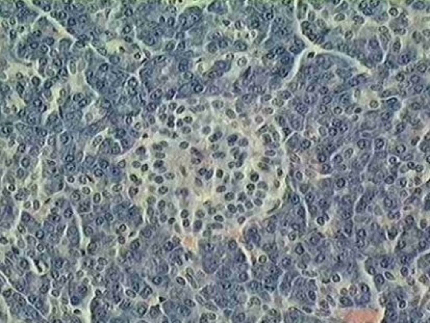<p>Islets of Langerhans of the Pancreas</p>