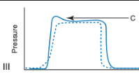 <p>What causes this?</p>