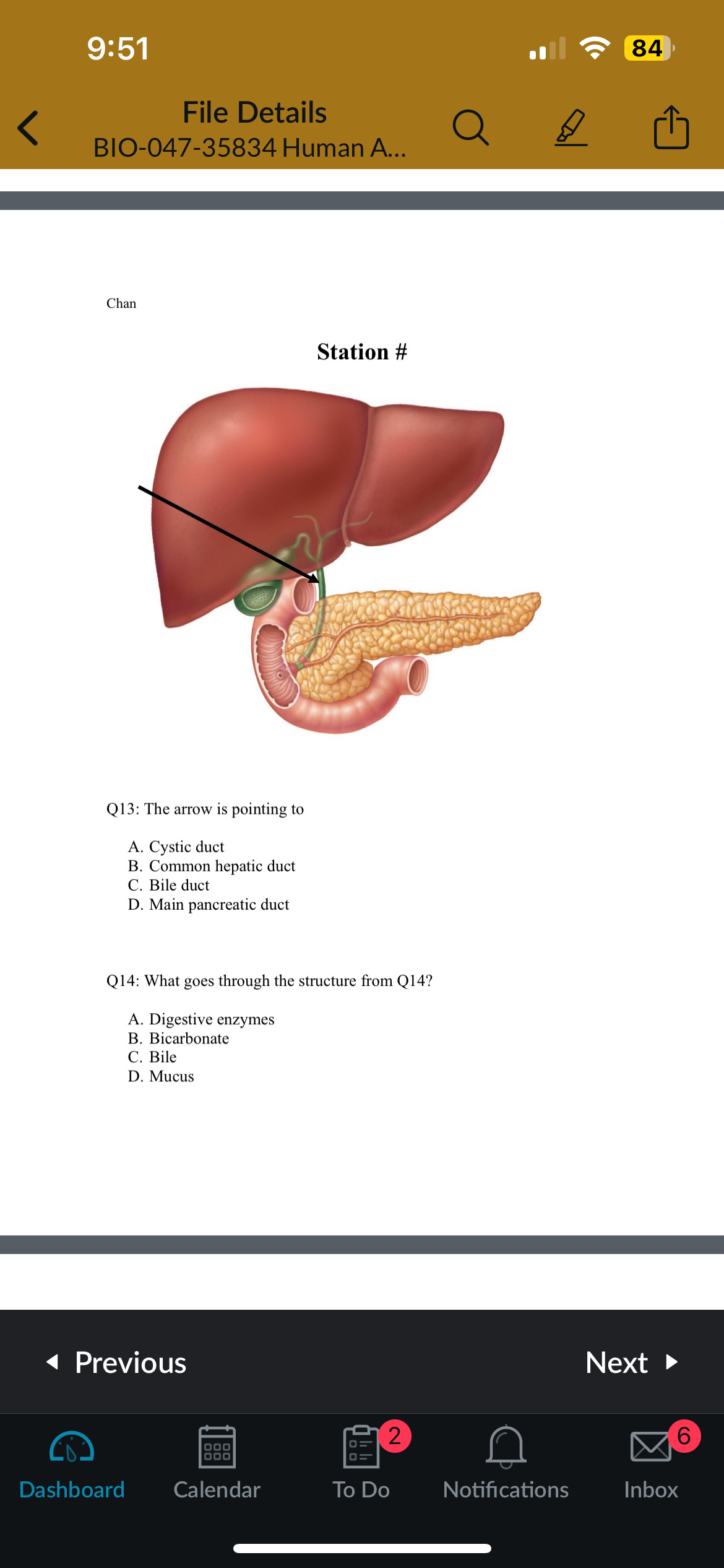 <p>Q14: What goes through the structure from Q13?</p>
