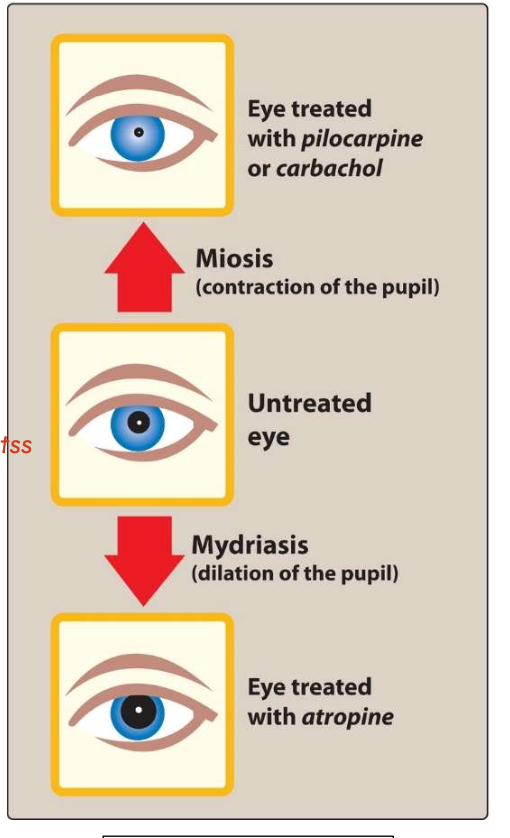 <p><span><strong><span>Therapeutic uses of Carbachol</span></strong></span></p><ul><li><p><span><span>Intraocular use provides miosis for eye surgery</span></span></p></li><li><p><span><span>Lowers intraocular pressure in the treatment of glaucoma.</span></span></p><p></p></li></ul><p><span><strong><span>Adverse effects</span></strong></span></p><ul><li><p><span><span>Few adverse effects with ophthalmologic use due to lack of systemic penetration</span></span></p></li></ul><p></p>