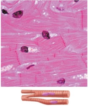 <p>Identify this type of muscle</p>