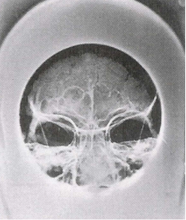 <p><span style="font-family: "Times New Roman";"><span>Cylinder Cone </span></span></p>