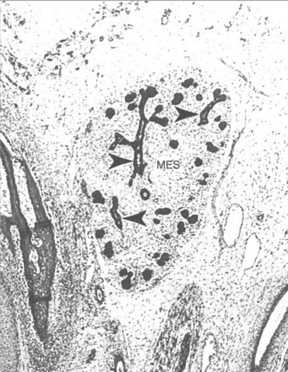 <p>distal</p><p>proximal</p><p>central</p>