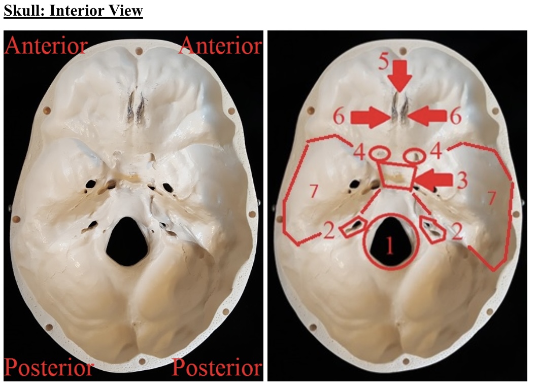 <p>7)name the butterfly chapel bone in the middle third of the skull</p>