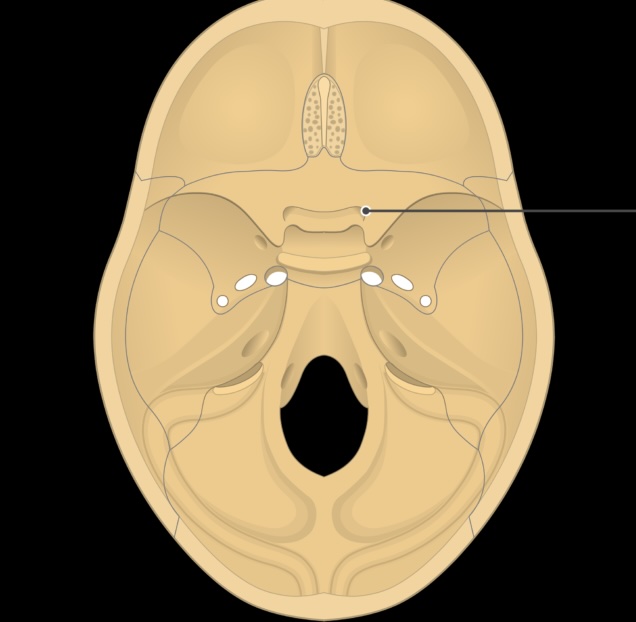 term image