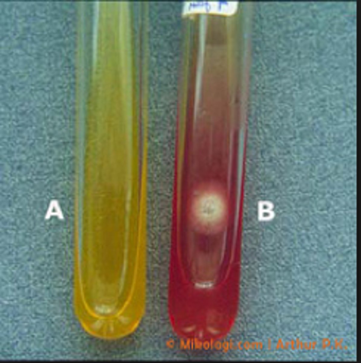 <p>Phenol red: red color appears in presence of alkaline metabolites</p><p>--chloramphenicol and cycloheximide inhibit other organisms</p>