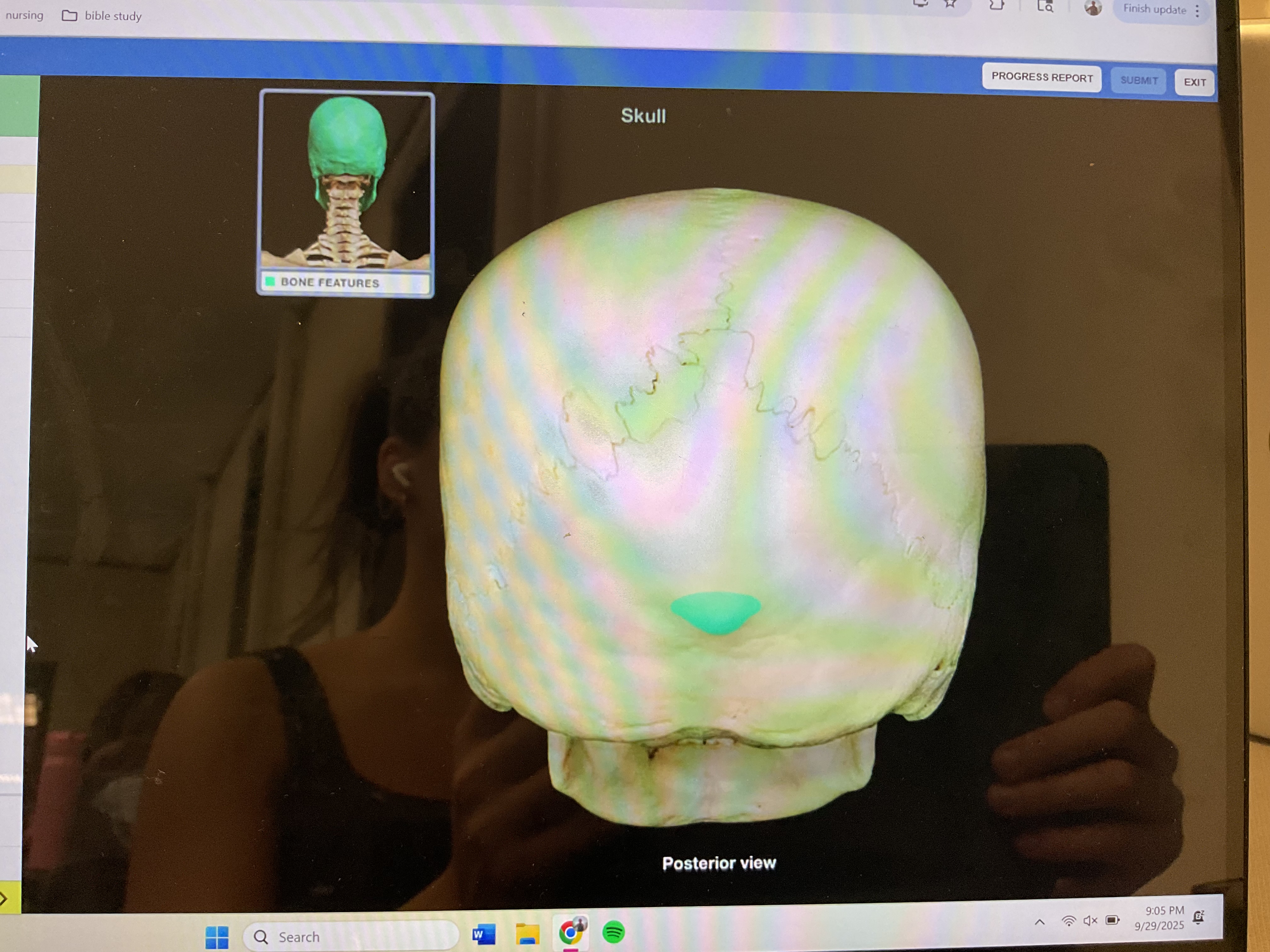 <p>External occipital protuberance</p>