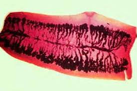 <p><span>Important diagnostic information may be provided by the accurate identification of a tapeworm proglottid found in a stool specimen. The gravid proglottid shown below is typical of which of the following species?</span></p><p>Diphyllobothrium latum</p><p>Hymenolepis diminuta</p><p>Hymenolepis nana</p><p>Taenia saginata</p><p>Taenia solium</p>