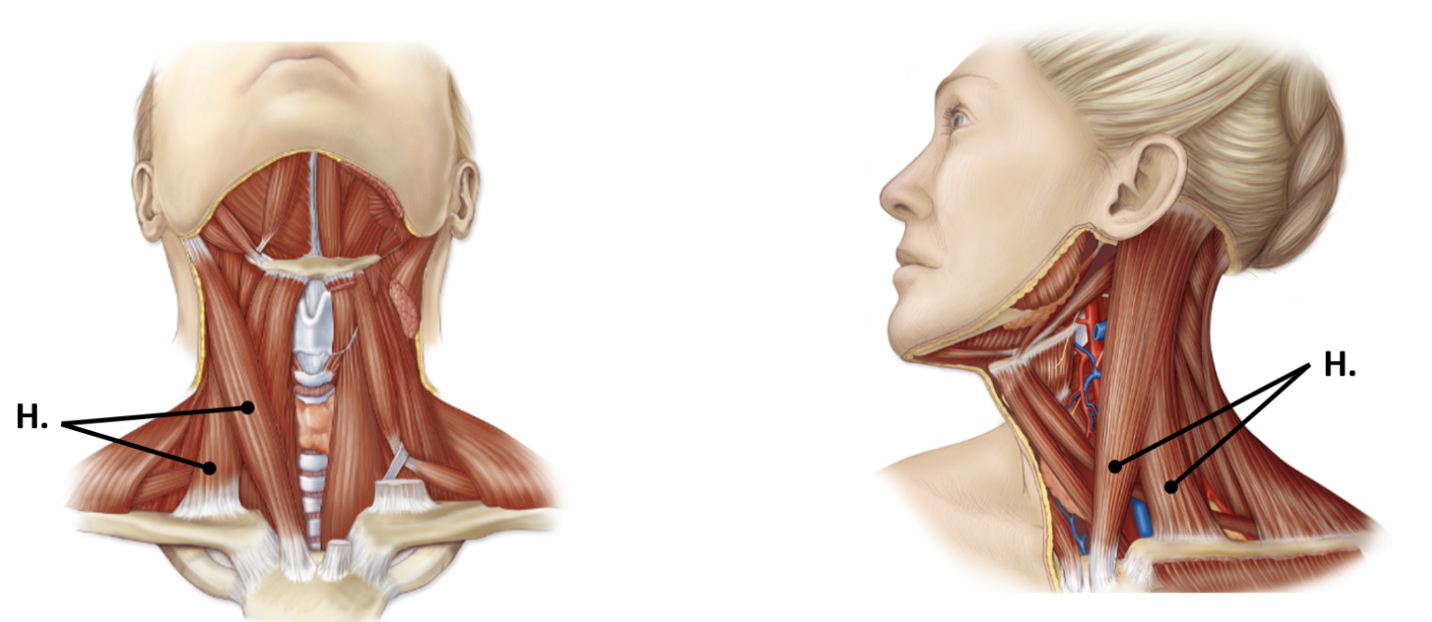 <p>runs diagonally across neck from sternum and clavicle to temporal bone; deep to platysma</p>