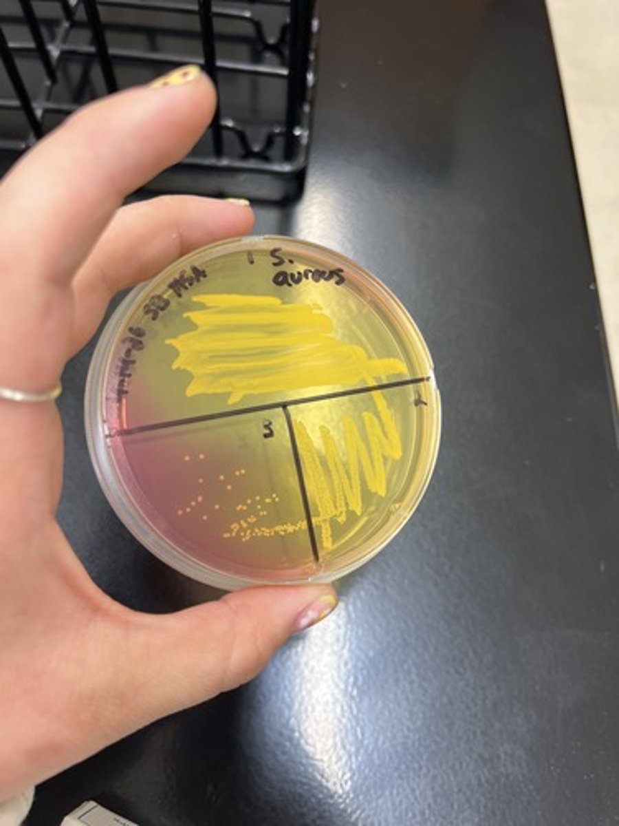 <p><strong>Selective </strong>for Halotolerant Organisms</p><p><strong>Differential </strong>for Mannitol fermentation</p><p>Fermentative (+): Yellow Agar</p>