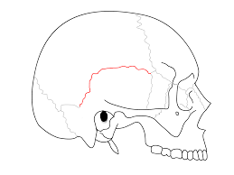 Between each parietal bone and temporal bone