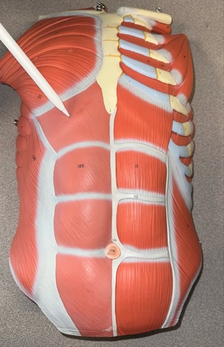 <p>Rectus Abdominis</p>
