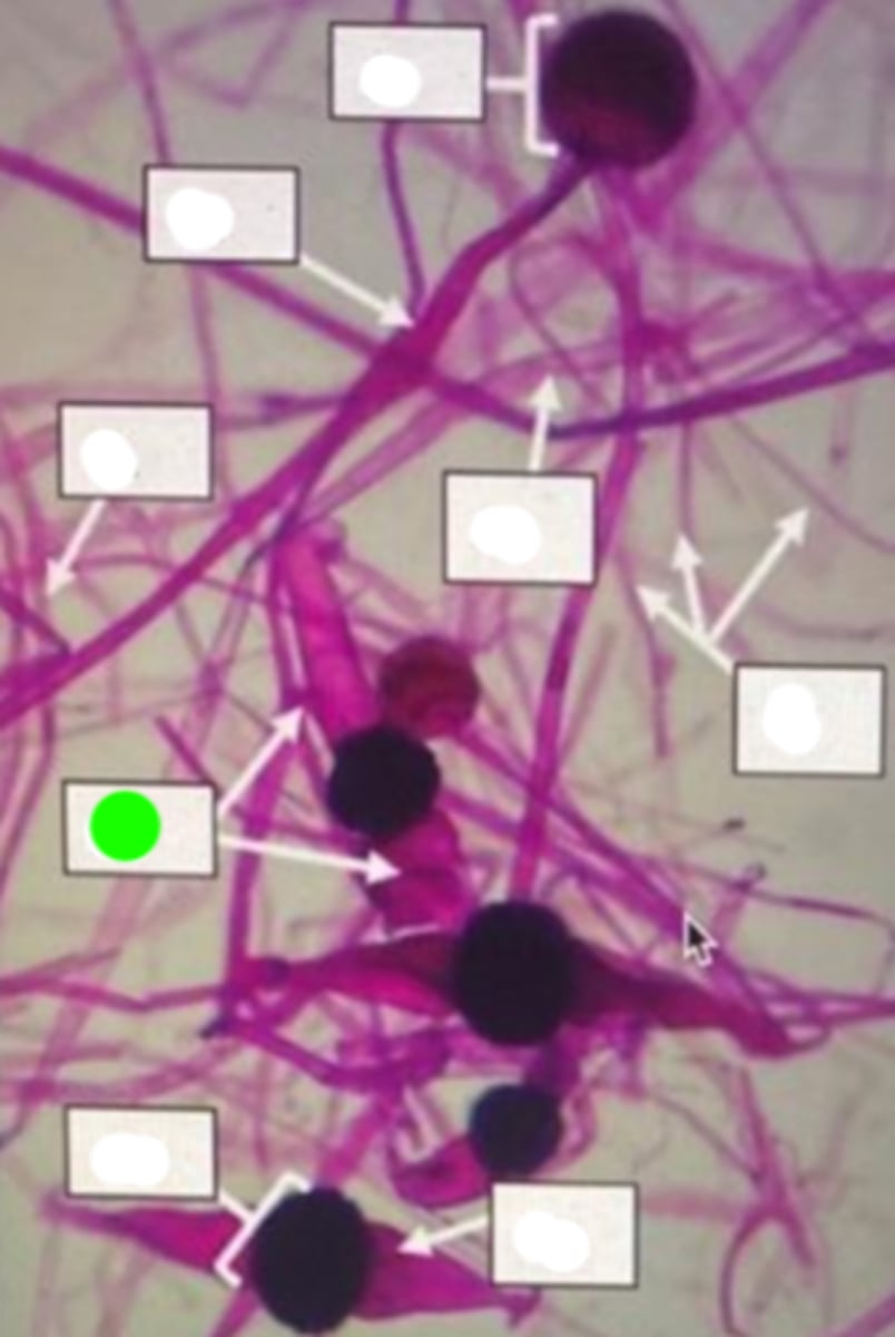 <p>A specialized cell attached to the spore, aiding in its dispersal.</p>