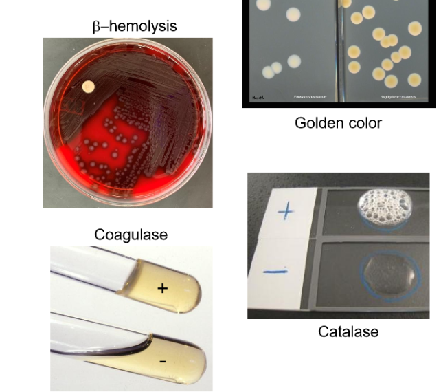 <p>Golden colonies&nbsp;</p><p>Beta Hemolysis on blood agar plate&nbsp;</p><p>Catalase + (turns more solid less liquid)</p><p>Coagulase + (Bubbles)</p>