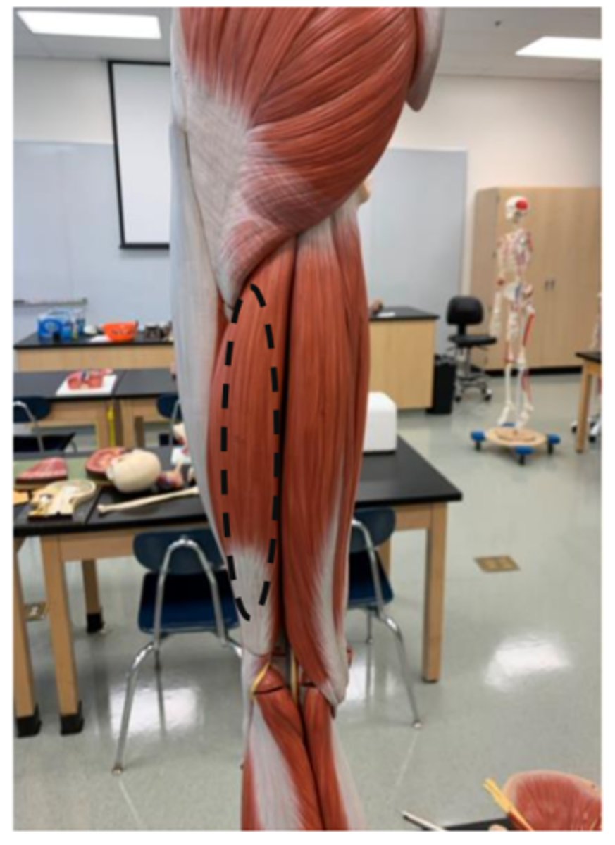 <p>posterior side (lateral)</p>