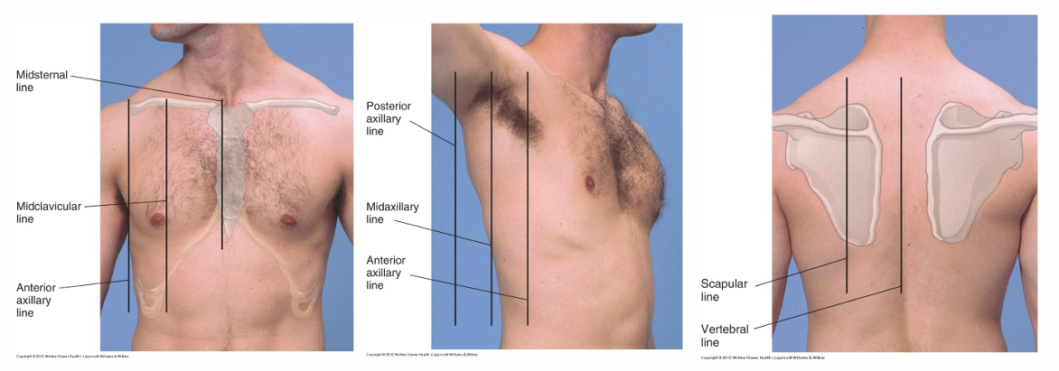 <p>midclavicular line=MCL</p>