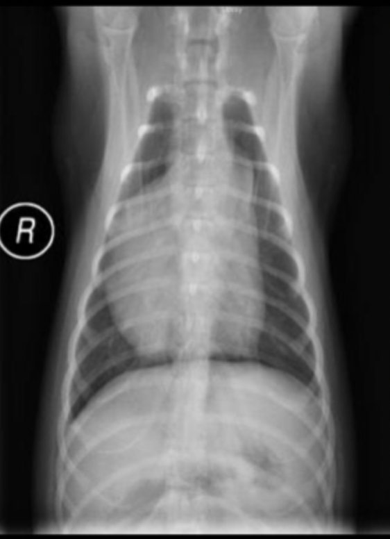 <p>What can be seen on this radiograph?</p>