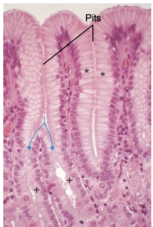 <ul><li><p><span style="font-family: ArialMT">Simple columnar epithelium</span></p></li></ul>