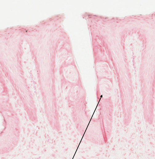 <p>what structure in a rabbit tongue is shown by the arrow in this image?</p>