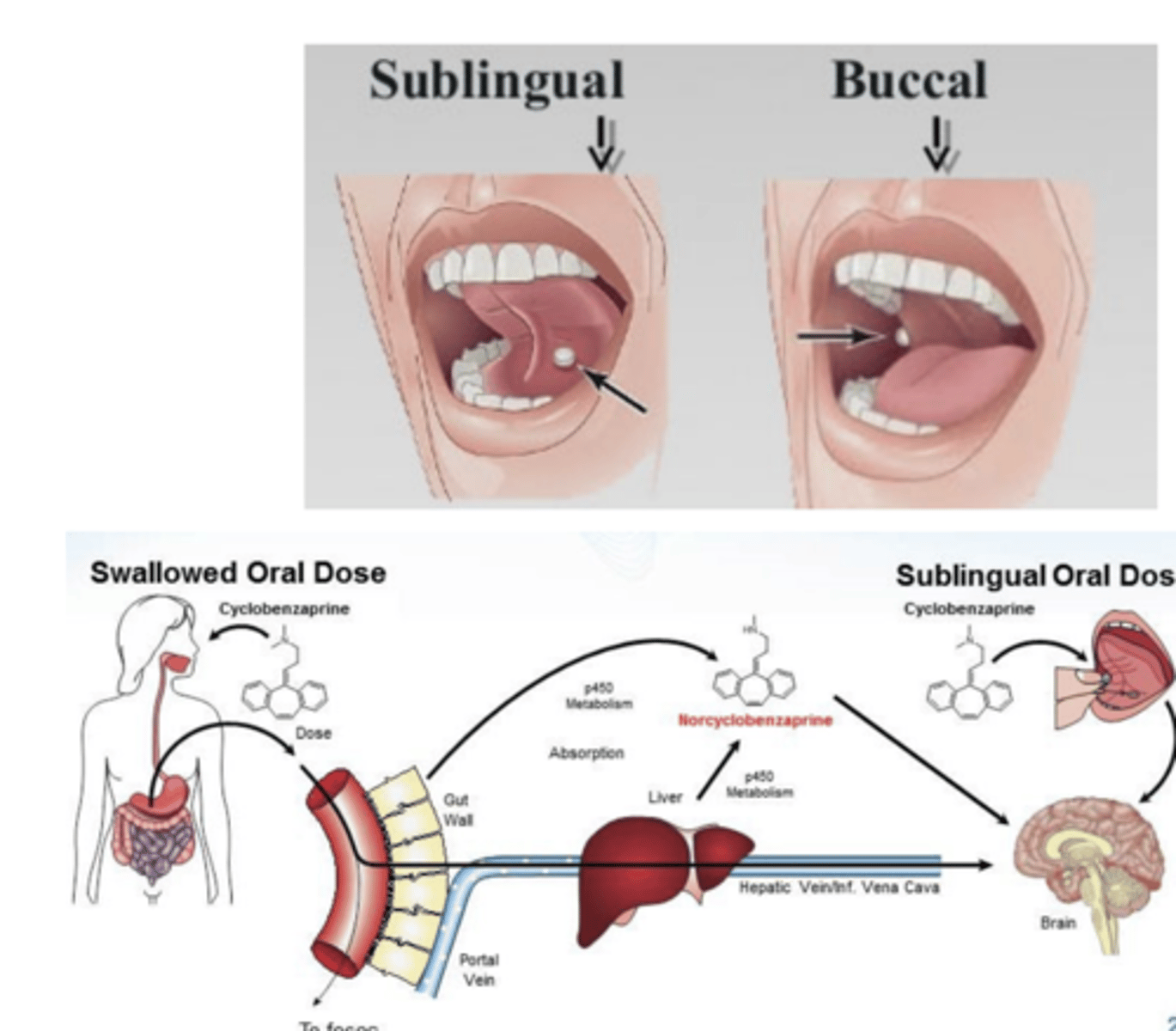 <p>- Bypass first-pass</p><p>- Rapid onset</p>