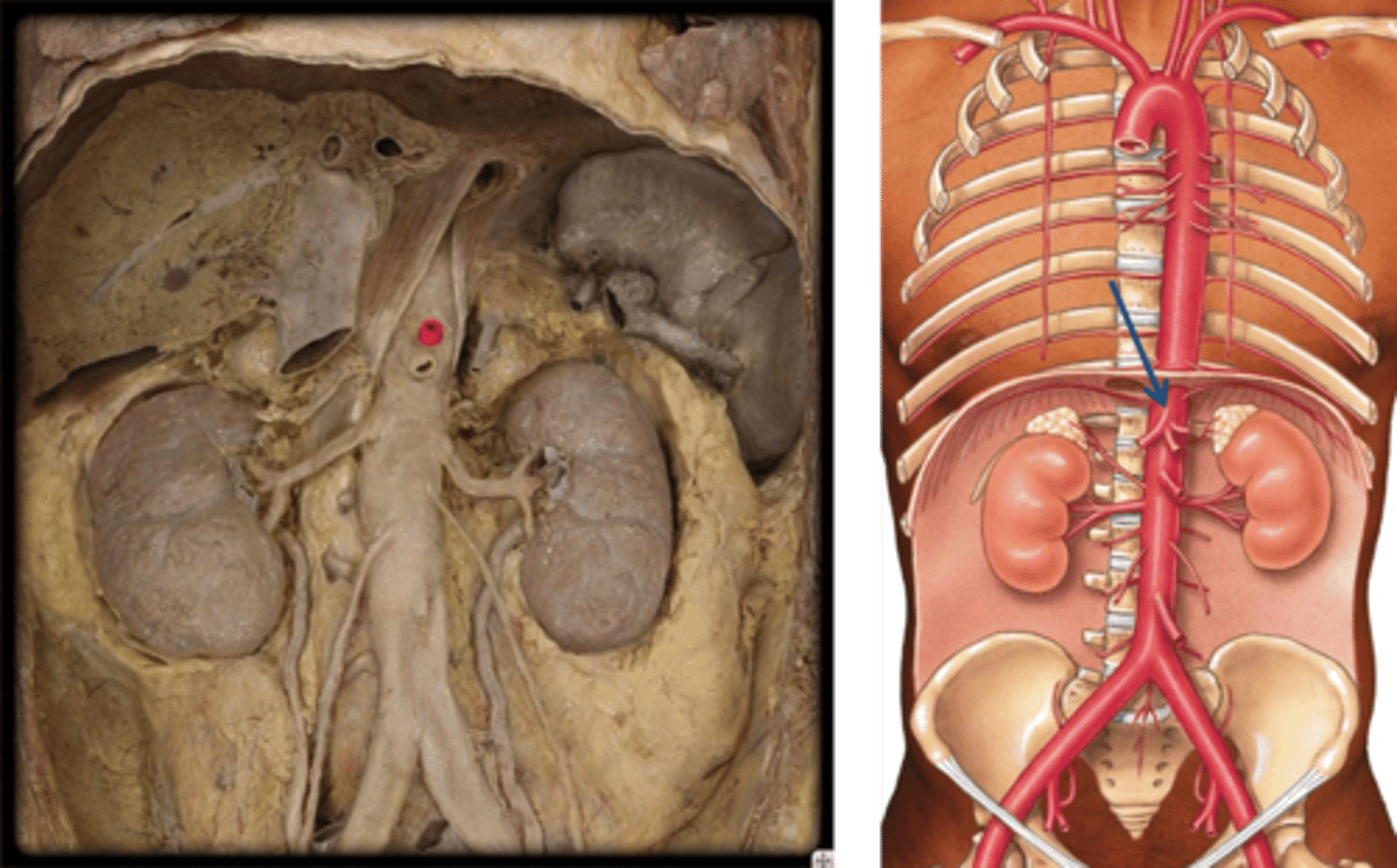 <p>Name this structure.</p>