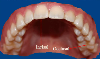 incisal and occlusal surfaces