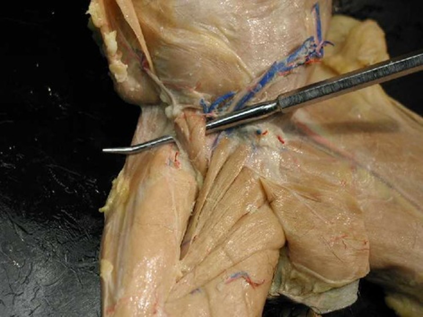 <p>origin: lumbar vertebrae T12-L5, inner surface of ilium</p><p>insertion: lesser trochanter</p><p>action: flexion, abduction, external rotation</p>