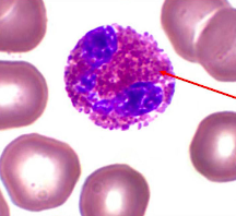 <p>type of white blood cell that fights infection</p>