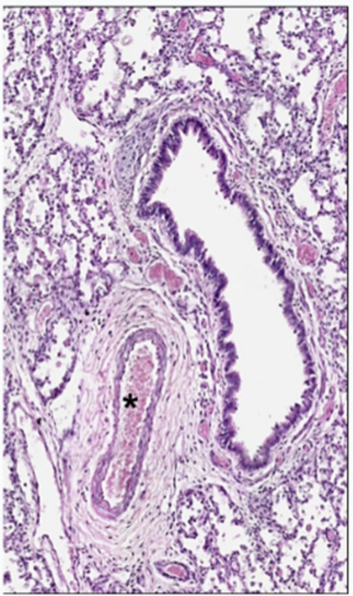 <p>Is the asterisked vessel conveying blood toward or away from the heart?</p>