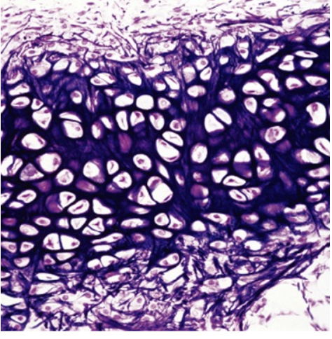 <p>(dark fibers)</p>